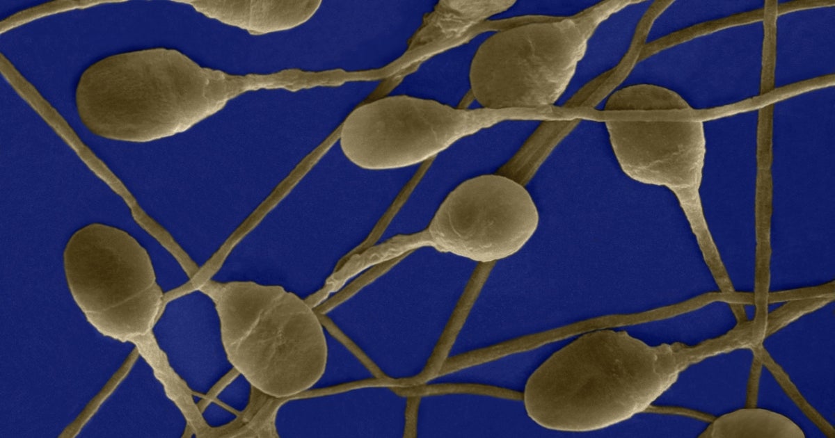 Sperm Quality Could Be Affected By This Chemical