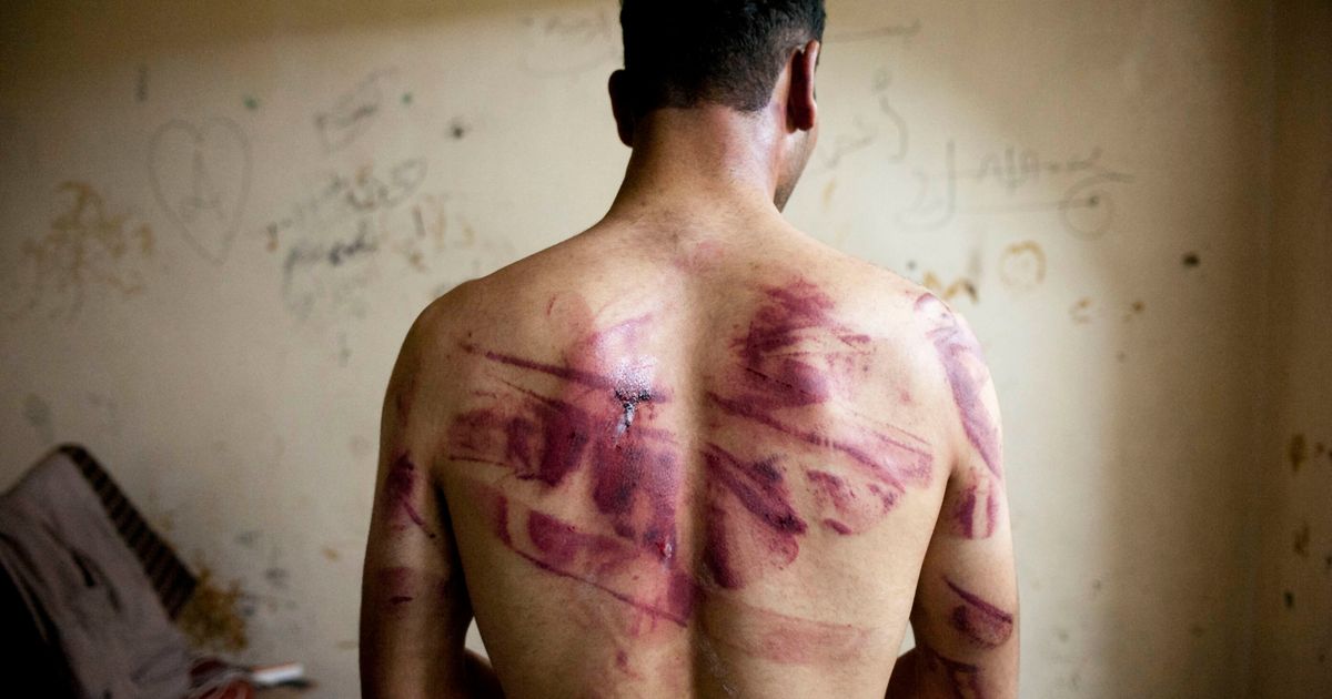 Tens Of Thousands In Syria Are Being Tortured And  Killed In Detention