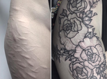 Tattoo Artist Covers Woman's Self-Harm Scars With Beautiful Design