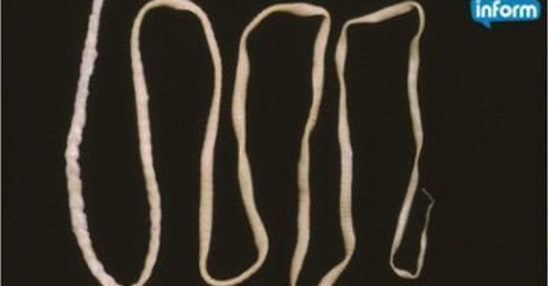 'Wiggling' Tapeworm Larva Found Deep Inside California Man's Brain ...