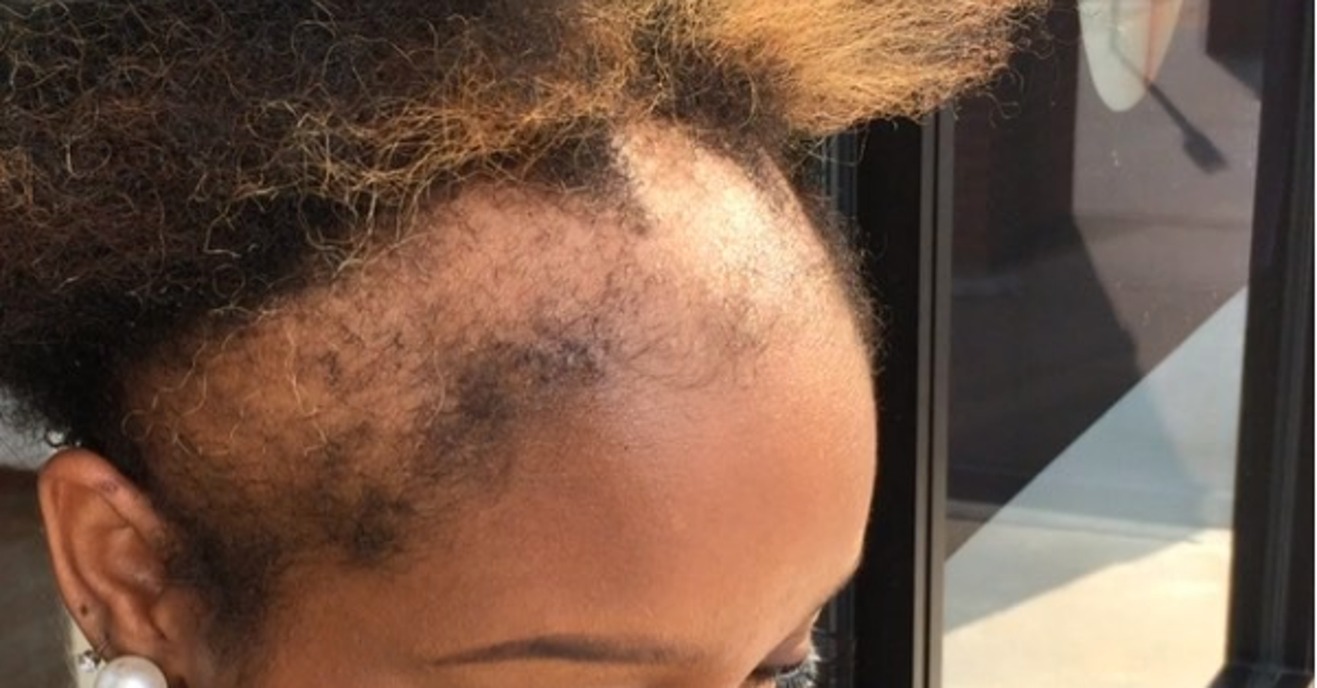 atlanta-hair-stylist-makes-a-serious-case-for-protecting-edges-huffpost