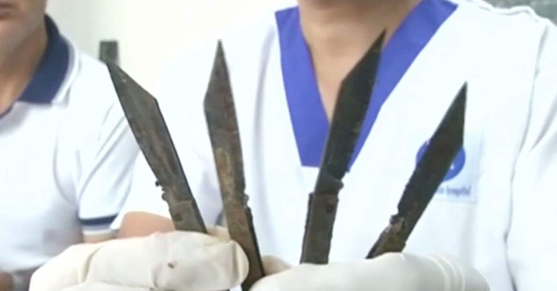 Man Of Steel Doctors Remove 40 Knives From Man’s Stomach HuffPost