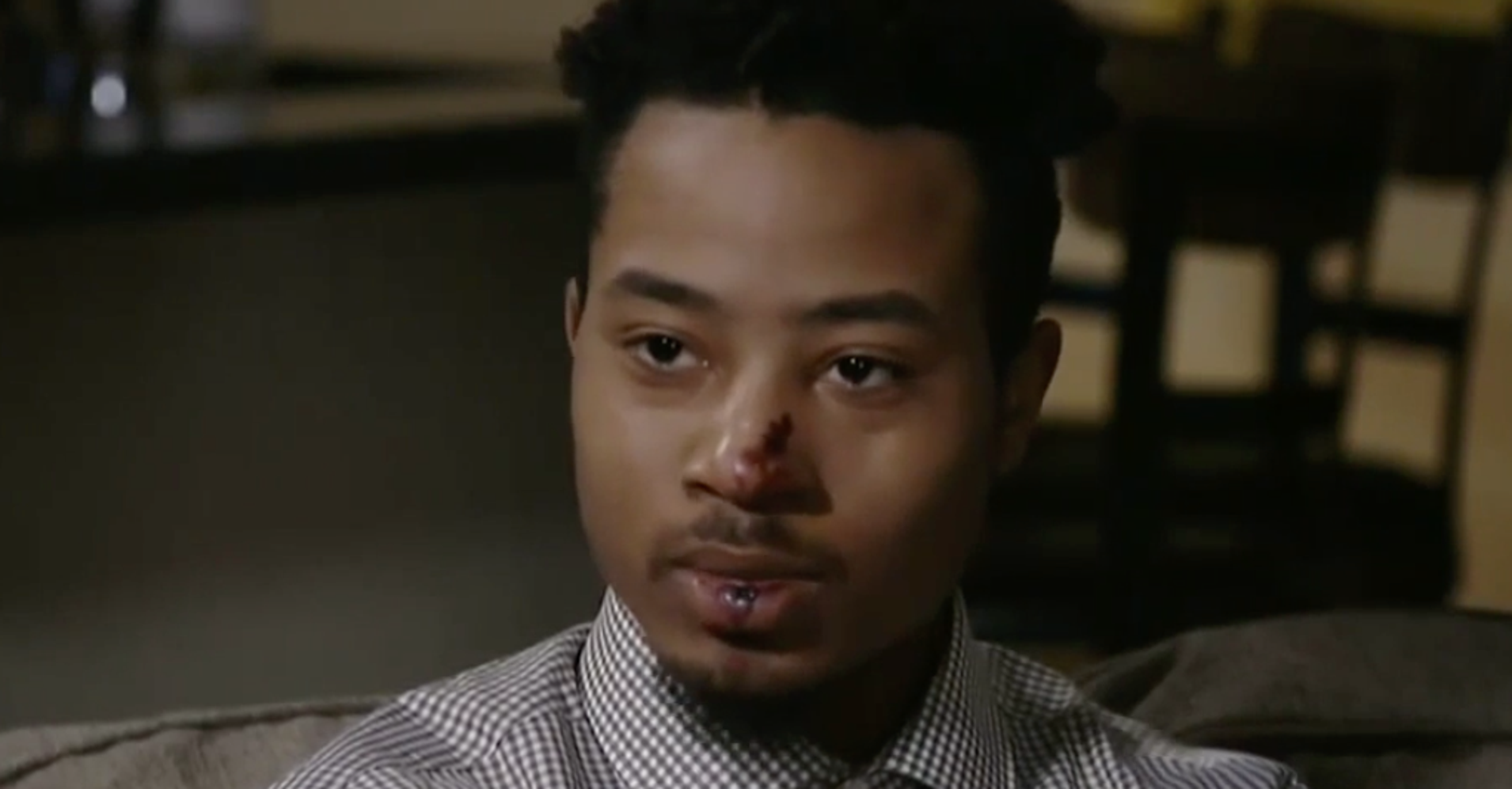 Young Man Beaten By Cops On Video Speaks Out After Officers' Firing