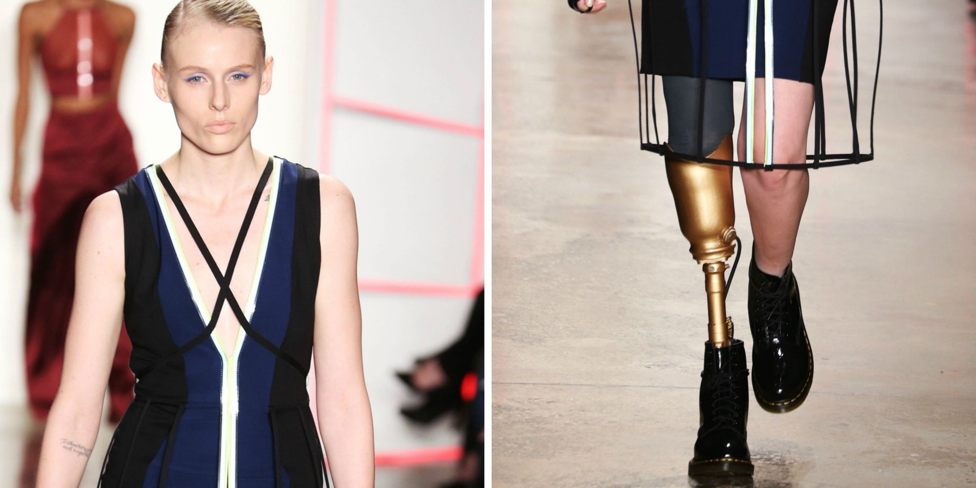 Model Who Lost Leg To Toxic Shock Syndrome Slays At Fashion Week The