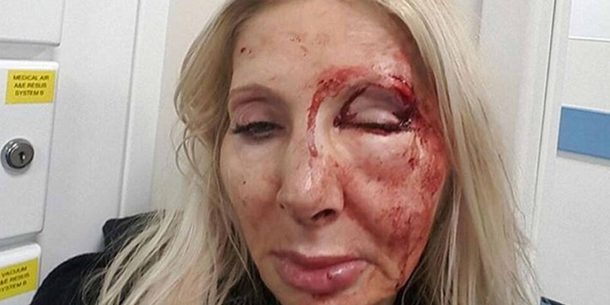 Warwick Avenue Tube Station Attack: Police Appeal For Witnesses