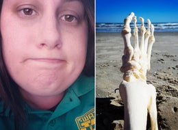 Cancer Survivor Takes Her Amputated Foot On Many Adventures