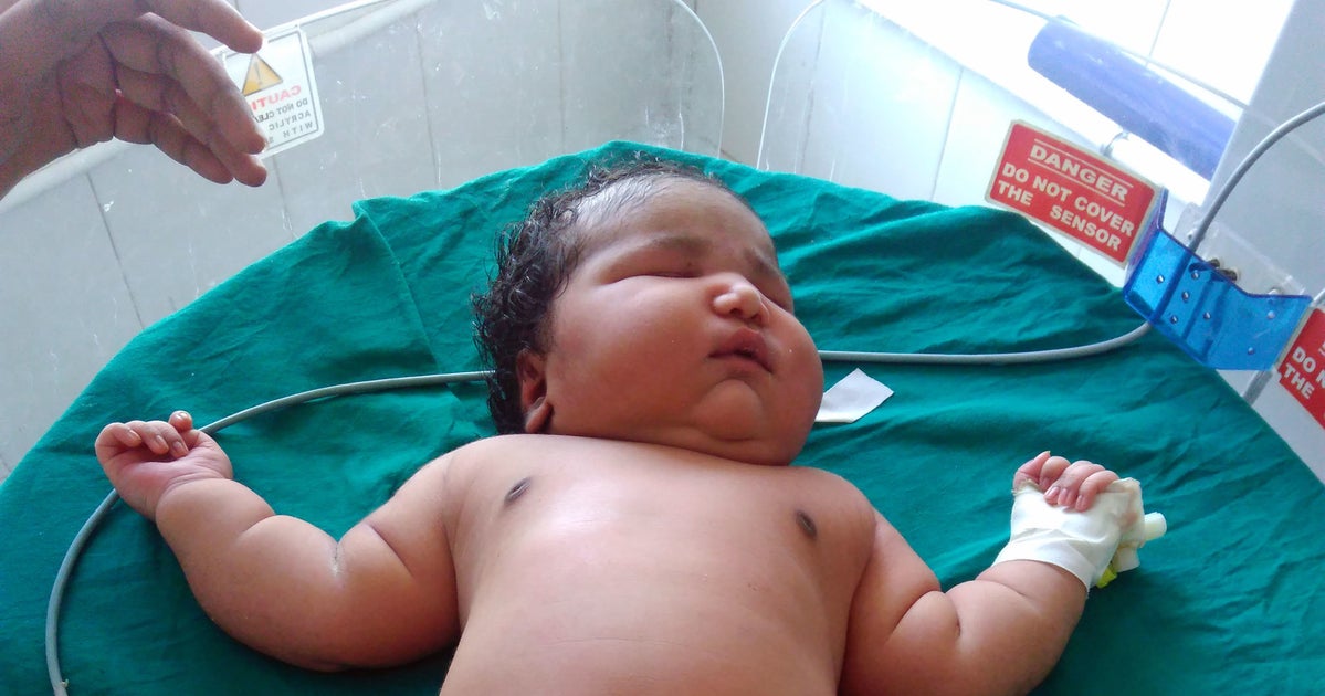 Mother In India Gives Birth To 'Heaviest Baby Girl Ever Born