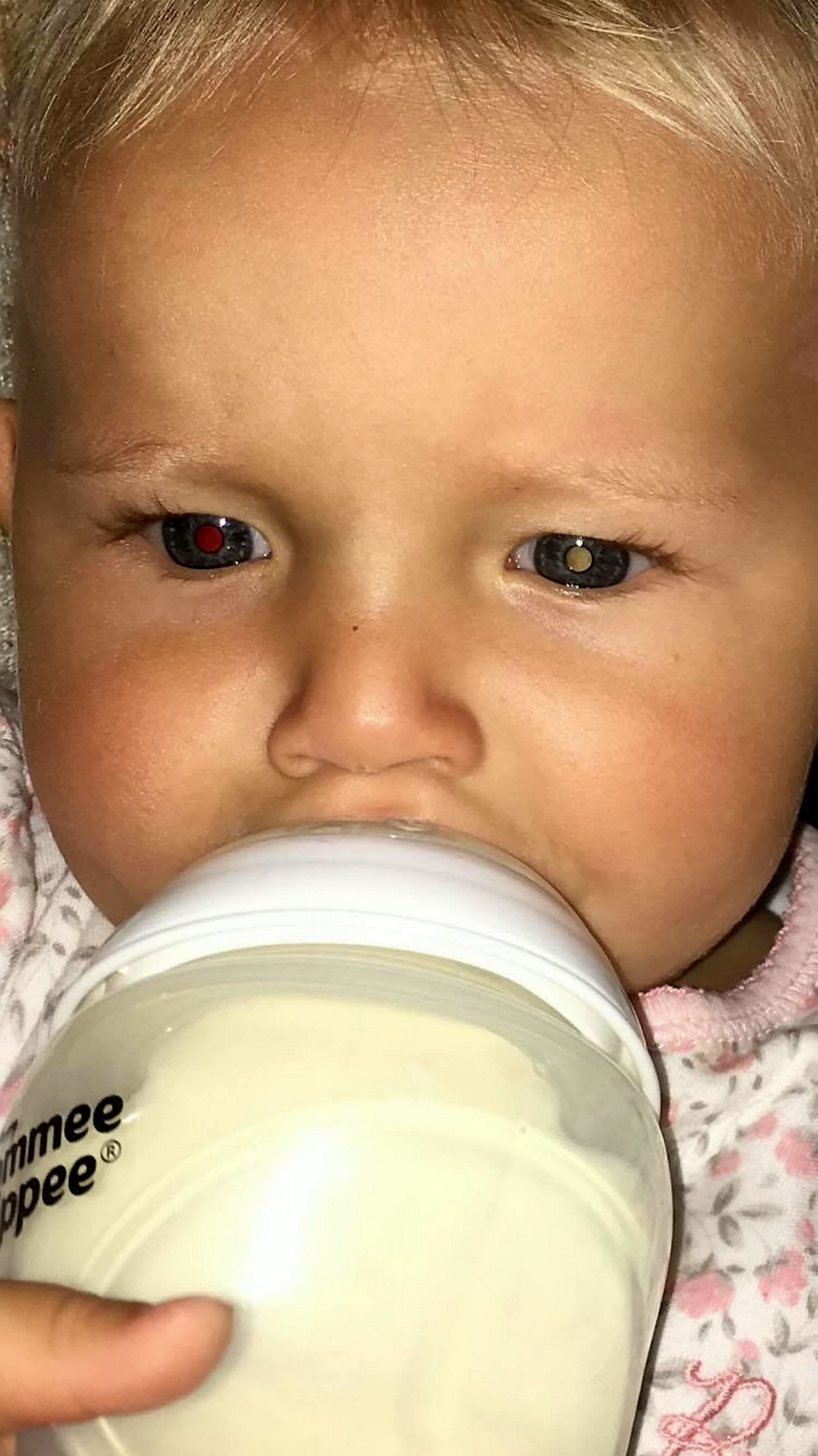 The photo&nbsp;Charlotte Salisbury shared on Facebook showing the "cat's eye" symptom of Retinoblastoma.