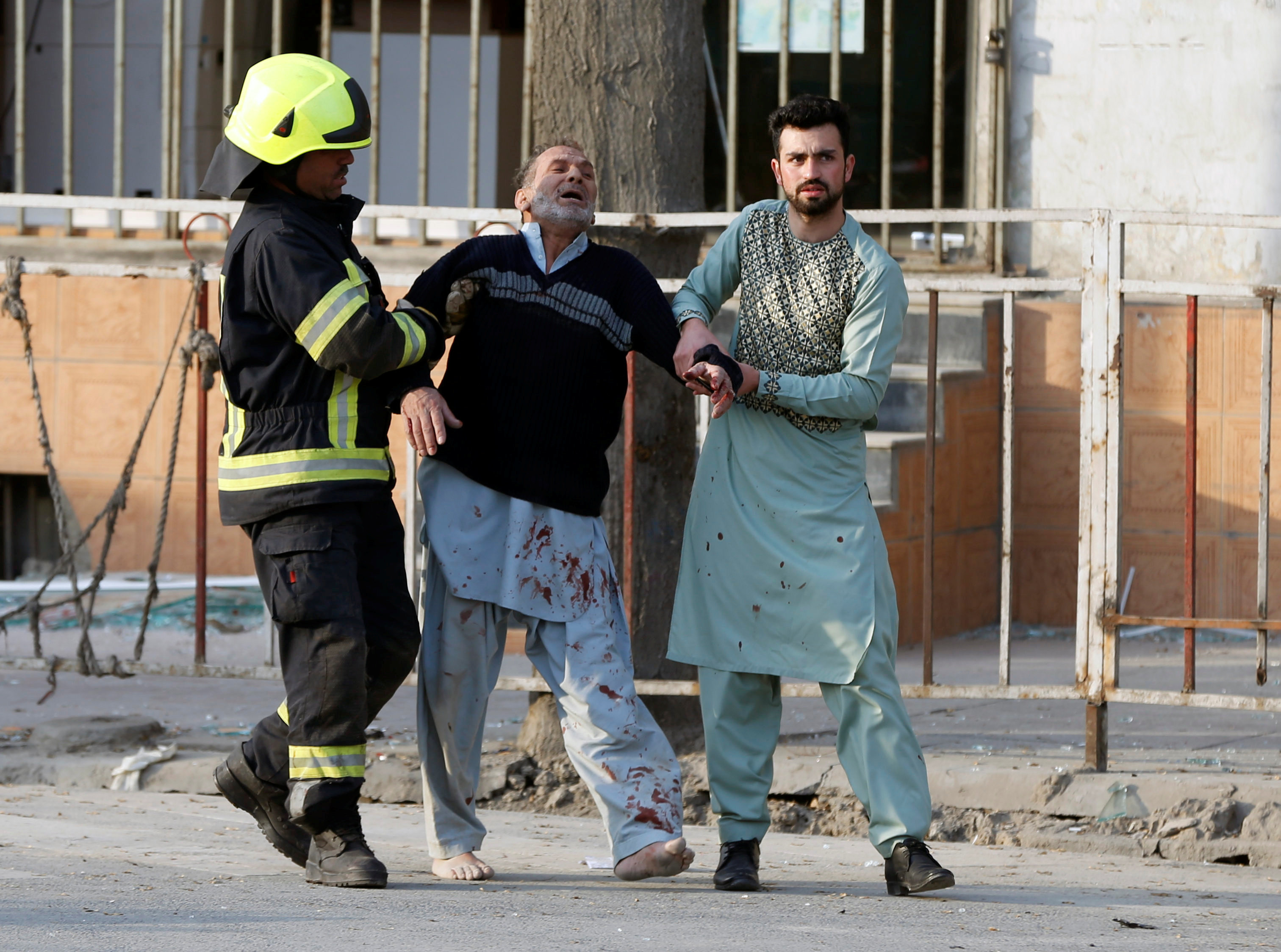 A man reacts after hearing his son was killed during the bomb attack