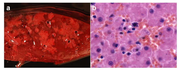 Hepatitis infecciosa canina en oso pardo.