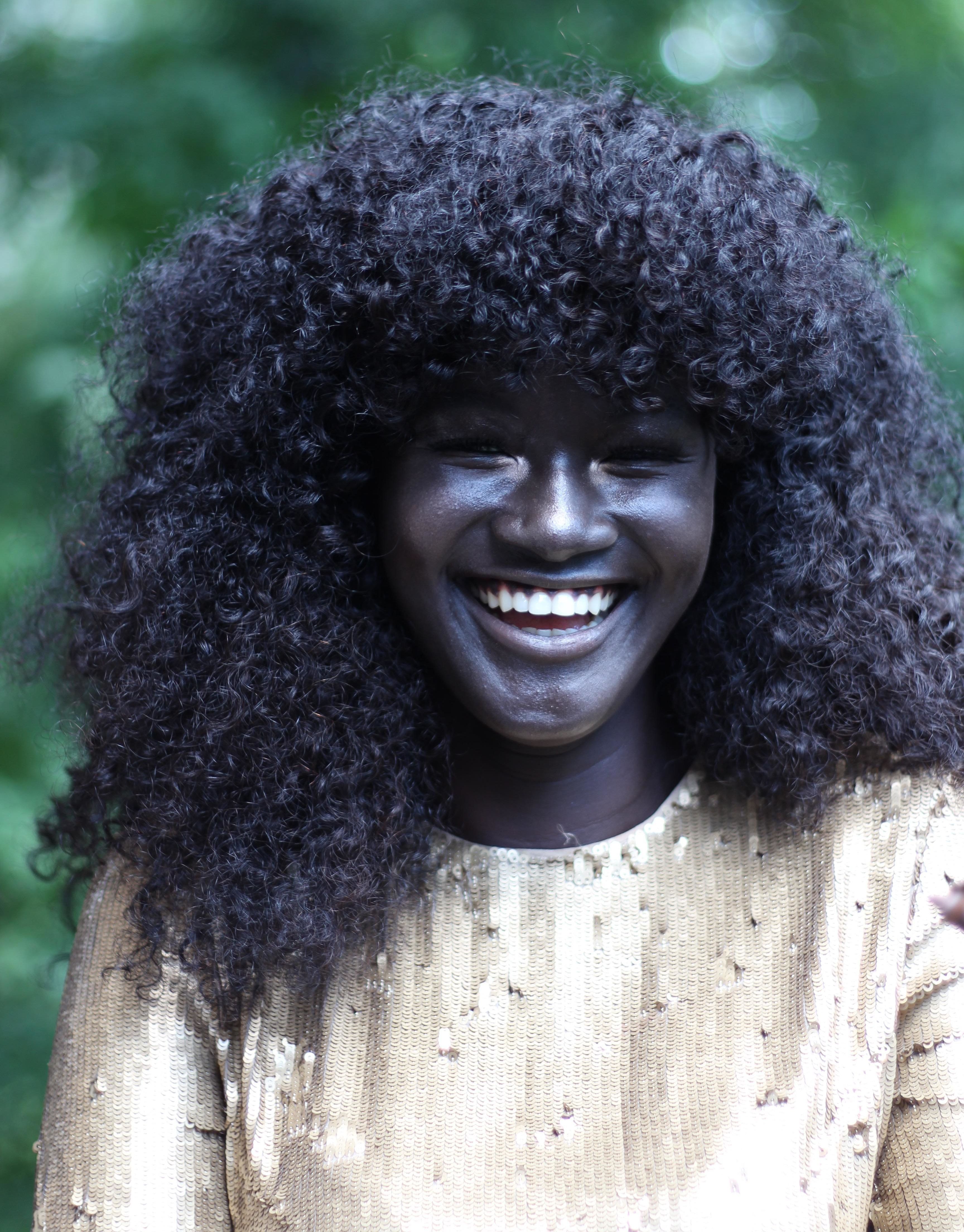 This Girl Was Bullied For Her Skin Color Now Shes A Badass Model Cambio