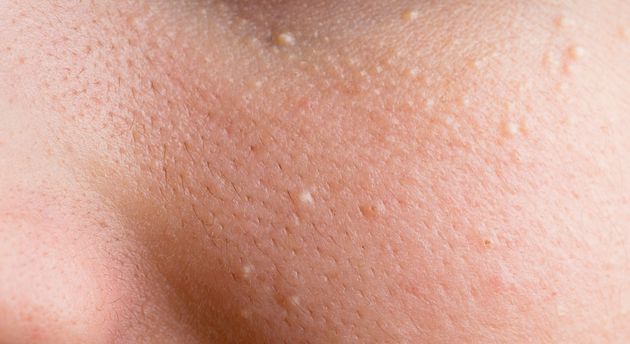 How To Easily Tell If A Skin Condition Is Dangerous Or Not The
