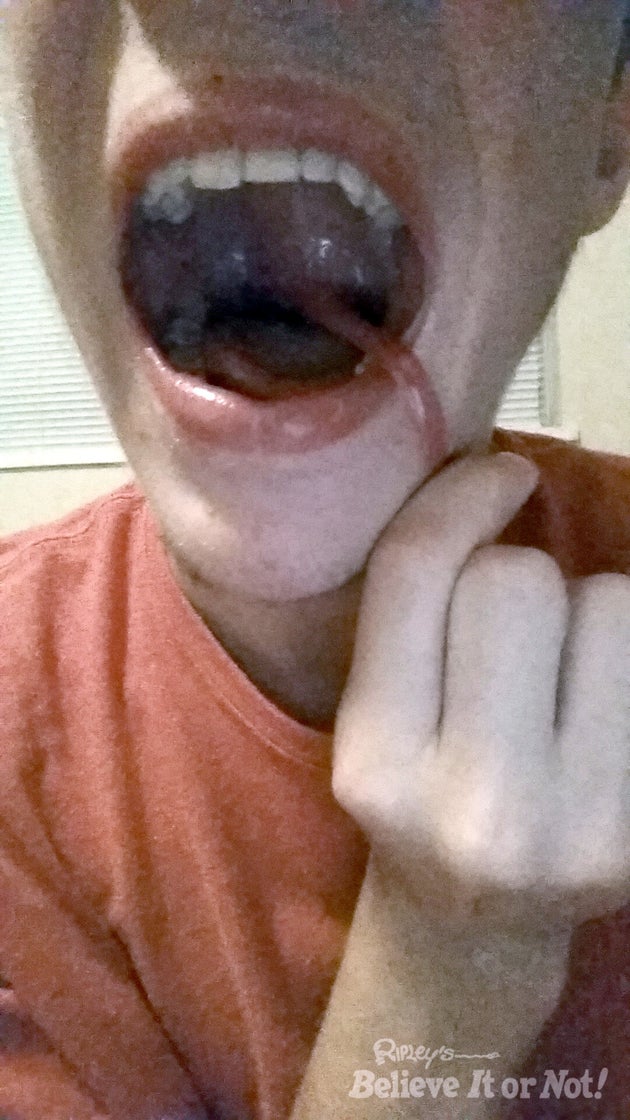 This Boy Can Stretch His Uvula To NeverBeforeSeen Lengths The