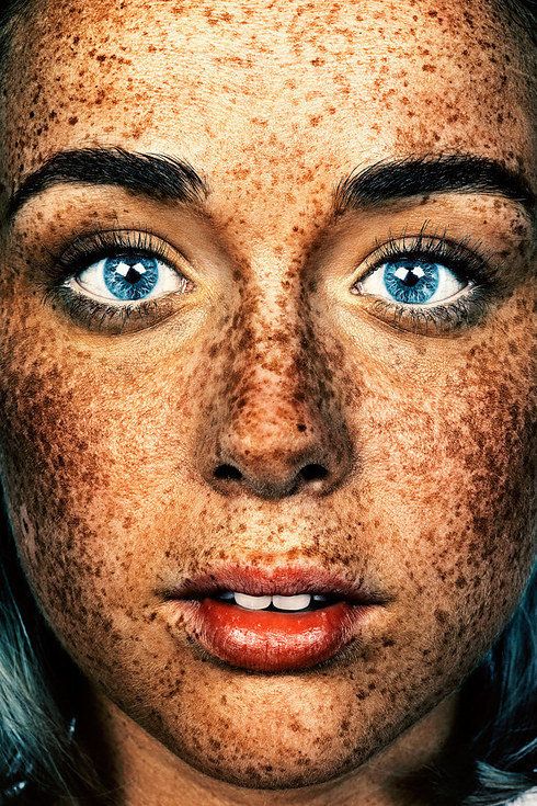 The Fabulously Freckled Get Their Close-Up In <b>Photo Project</b>. “ - 569514992a00002d00030471