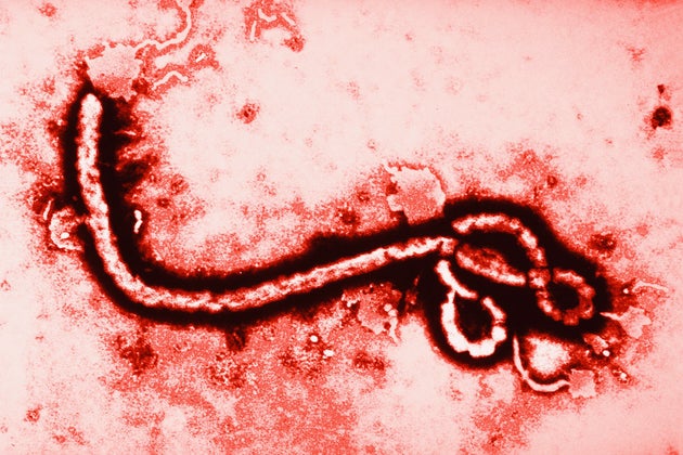 Ebola RNA can remain in semen for hundreds of days