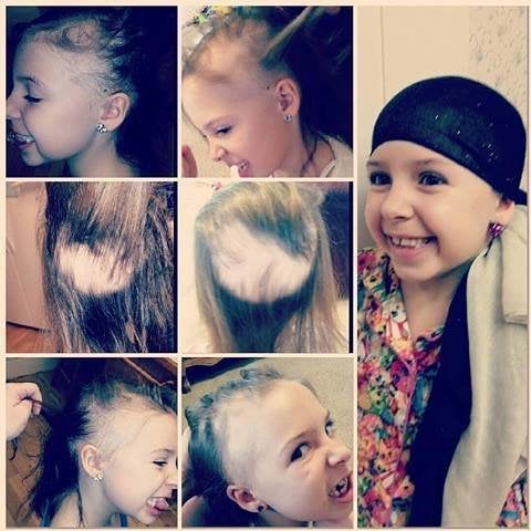 Girl With Alopecia Wins School Competition With Gorgeous Jeweled Head Girl With Alopecia Wins School Competition With Gorgeous Jeweled Head