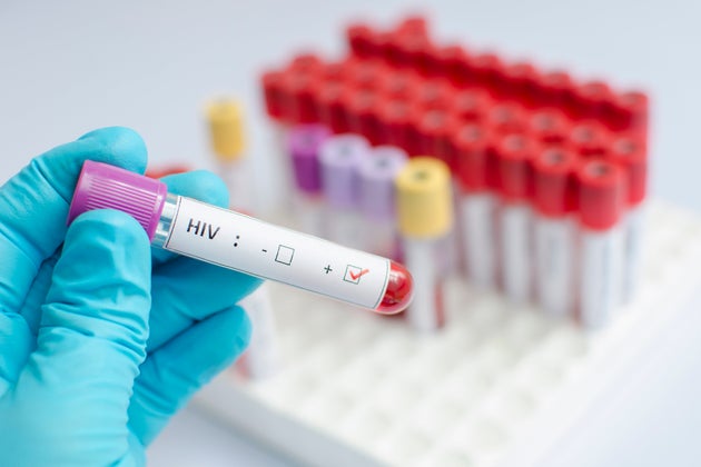 CRISPR Eliminates HIV in Live Animals