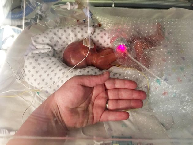 one-of-britain-s-most-premature-babies-defies-odds-after-being-born