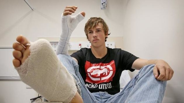 Australian man has big toe replace thumb after bull accident