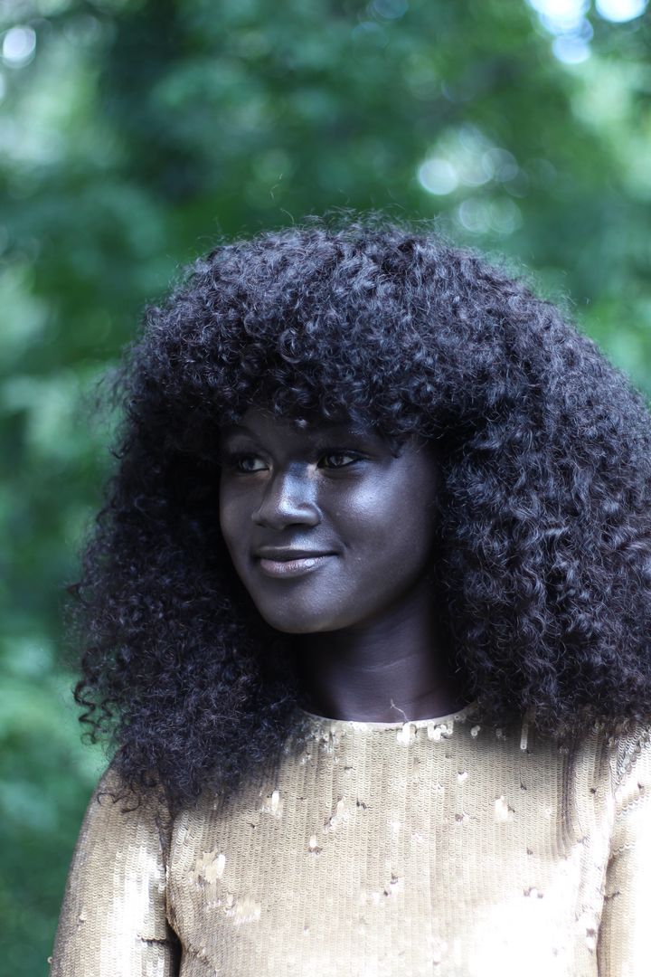 This Girl Was Bullied For Her Skin Color Now Shes A Badass Model 4621