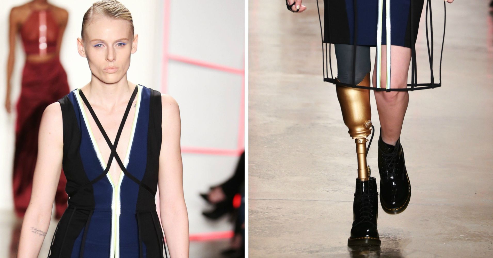 Model Who Lost Leg To Toxic Shock Syndrome Slays At Fashion Week | HuffPost