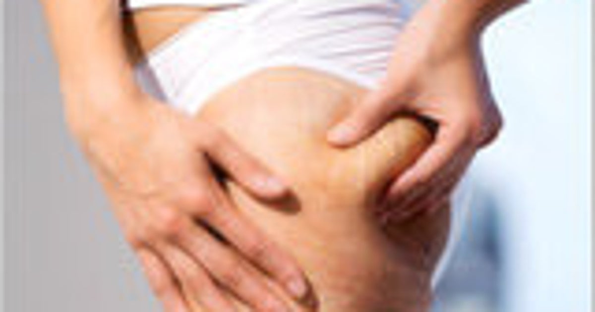 The 7 Biggest Myths About Cellulite | HuffPost Post 50