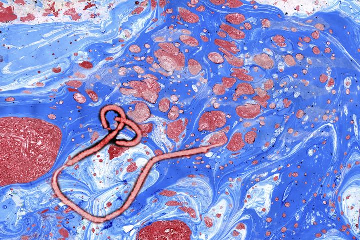 Ebola virus seen under a microscope
