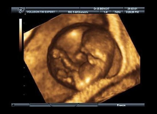 7 Awesome Things Your Body Does During Pregnancy | HuffPost Life