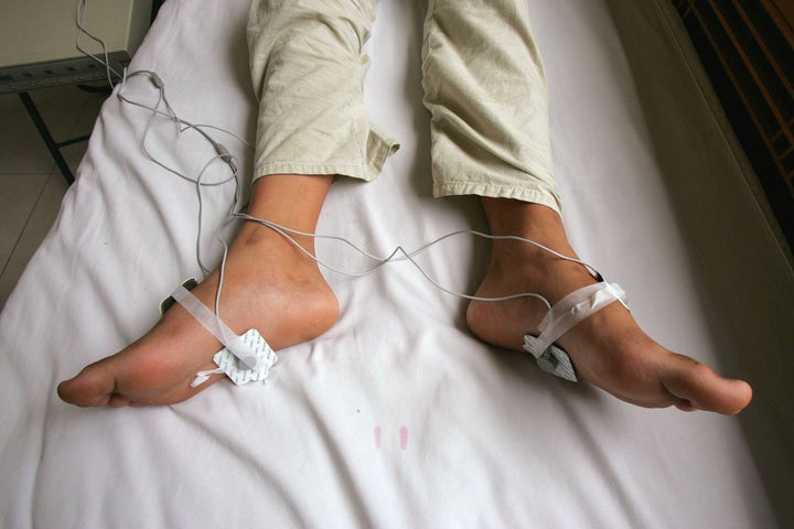 A 12-year-old boy receives electric shock treatment for his Internet addiction at the Beijing Military Region Central Hospital in Beijing on June 17, 2005. The boy had become so addicted that he spent four days straight at an Internet cafe, barely eating or sleeping.