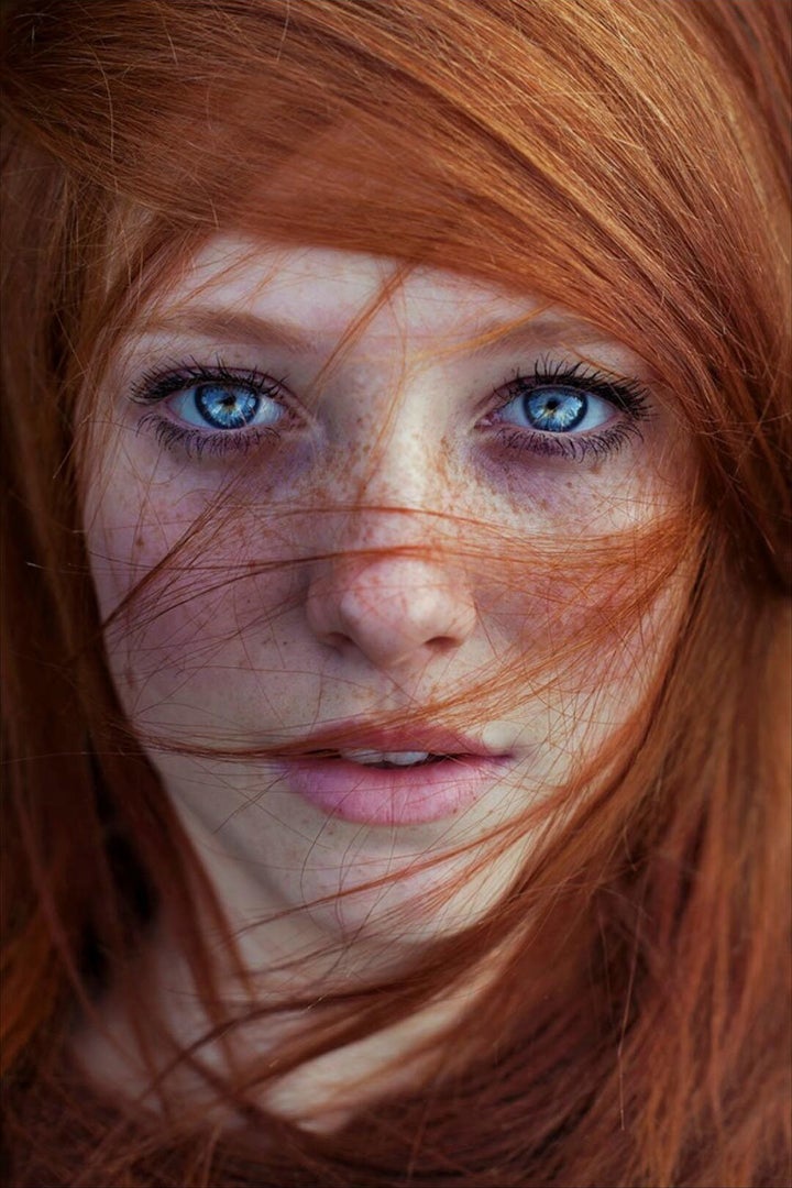 Ginger with freckles