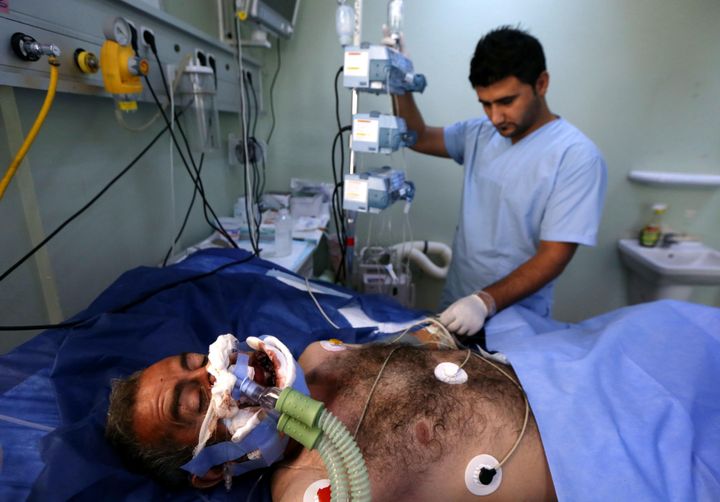 A wounded Iraqi Kurdish man receives treatment at a hospital in Arbil, the capital of the autonomous Kurdish region of northern Iraq, on August 2, 2015, following air strikes by Turkish warplanes against the Kurdistan Workers' Party (PKK) positions in the Kurdish village of Zergale in the Qandil mountains, the PKK headquarters in northern Iraq. 