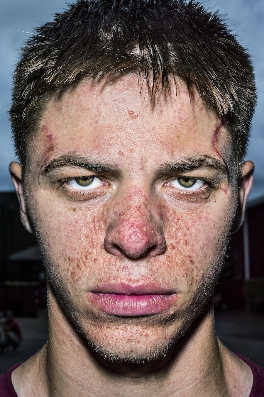 Painfully Close Photos Of Human Faces Look Strangely Inhuman HuffPost   55c152bf17000026005669c0 