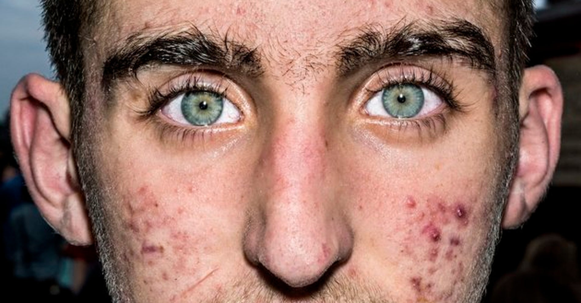 Painfully Close Photos Of Human Faces Look Strangely