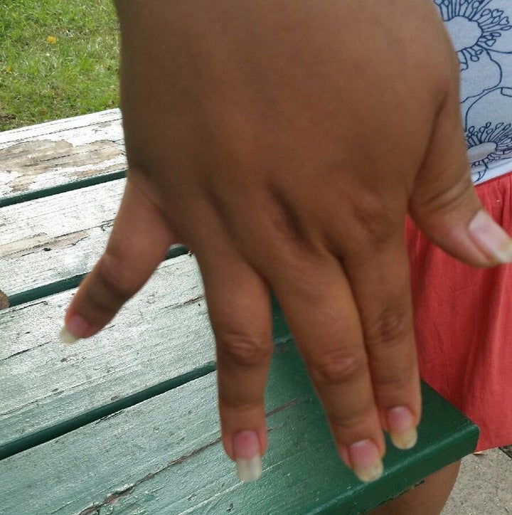 <p><span style="background-color: #eeeeee;"><span style="font-family: Arial, Helvetica, sans-serif;"><span style="font-size: 14px; line-height: 20px;">Yancy Mejía's pinky finger twists to the right, while her ring finger bends to the left -- the result of bone fractures suffered during beatings by a gang. She says she asked for treatment at a family detention center, but guards told her to simply drink more water.</span></span></span></p>