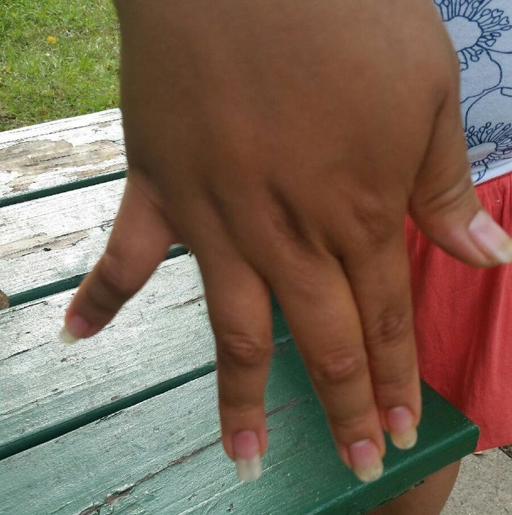 Yancy Mejí­a's pinky finger twists to the right, while her ring finger bends to the left -- the result of bone fractures suffered during beatings by a gang. She says she asked for treatment at a family detention center, but guards told her to simply drink more water.