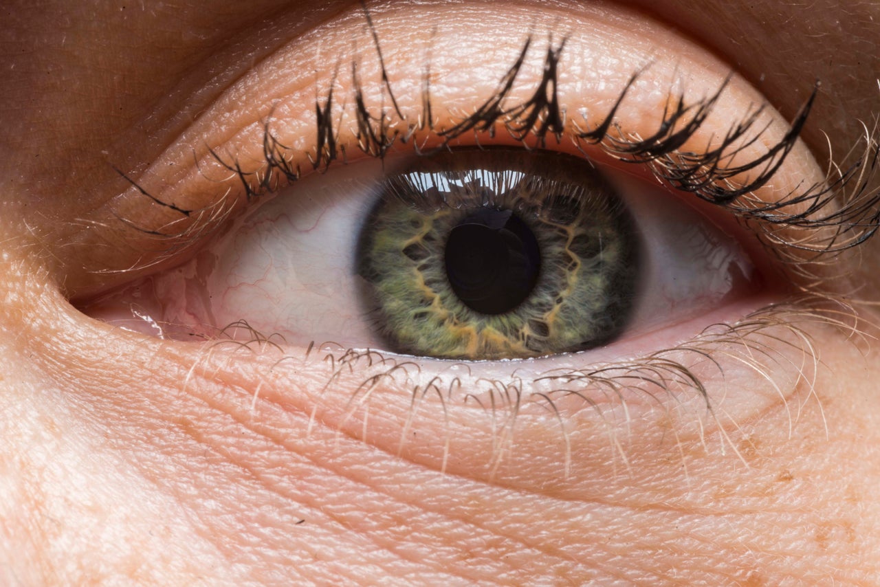 <p><strong><span style="font-size: 14.9999990463257px;">It looks similar — but also so different — from what I see every day in the mirror. I never knew how much yellow I have in my eyes!</span></strong></p>