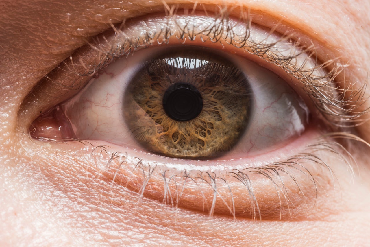<p><strong><span style="font-size: 14.9999990463257px;">I see a bunch of trees growing out of a swamp. I also see it's time to invest in a good eye cream.</span></strong></p>