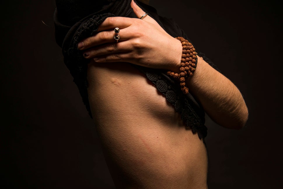 24 Women Bare Their Scars To Reveal The Beauty In Imperfections