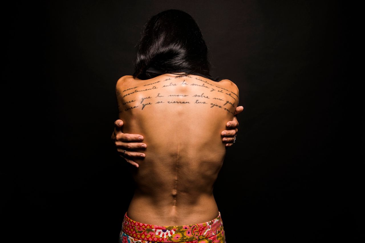 My back was broken in a car accident. The scar is from a resulting thoracic spinal fusion.Before the accident I was a ballet dancer, afterwards I was lost and heartbroken.My scar represents a wound that is emotional as well as physical. I know that I am a survivor, that I am adaptive and that I can bend my will to accommodate the path put in front of me.-- Mara, 40