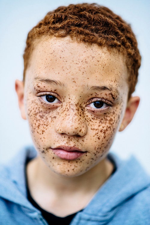 melanotan redhead w/ freckles : r/Melanotan2 Therapeutic Goods Administration cracks down
