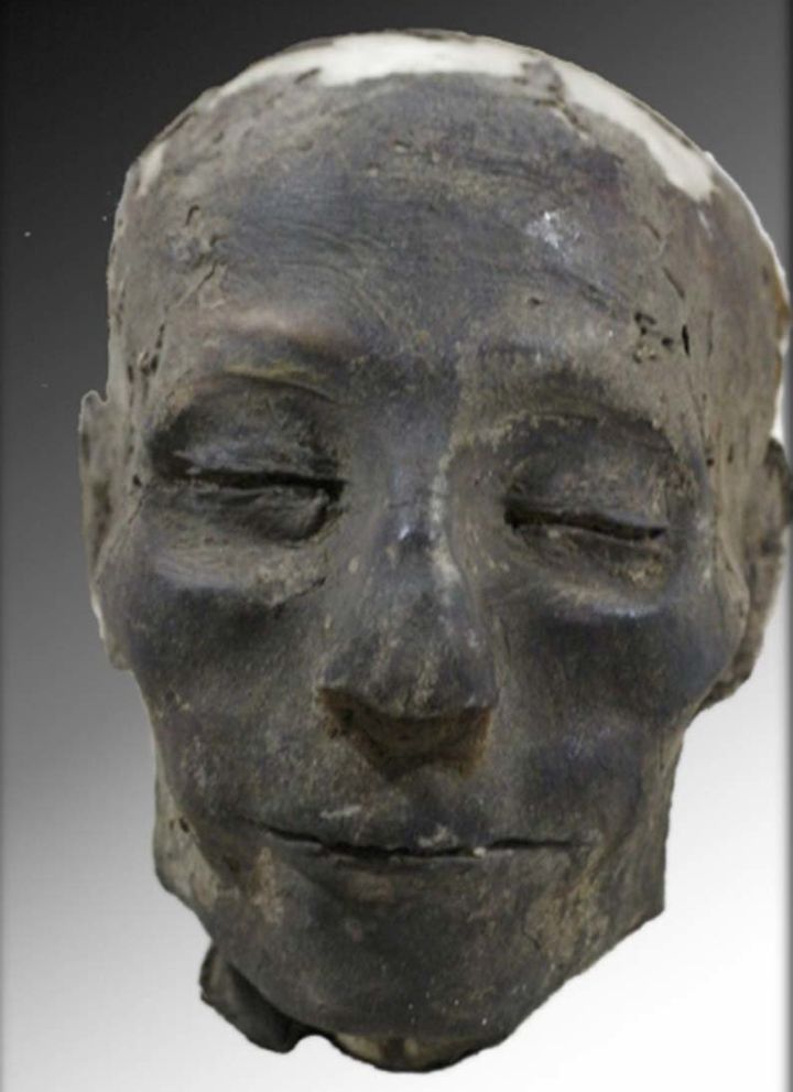The Nebiri mummy that may represent the oldest known victim of chronic heart failure.