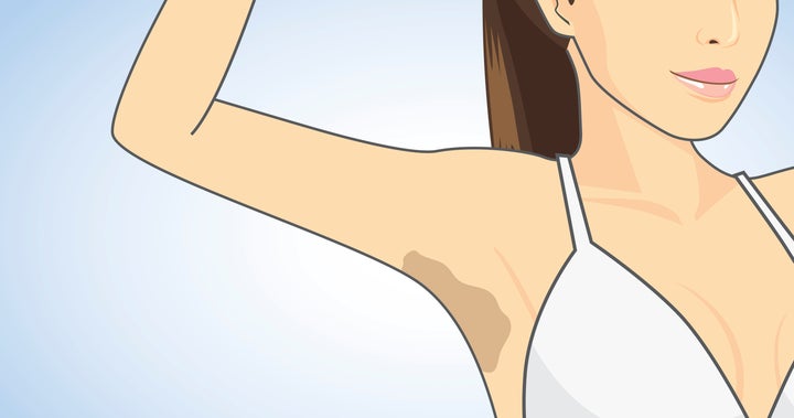 No Lemon Juice Will Not Lighten Your Armpits Here S The Deal
