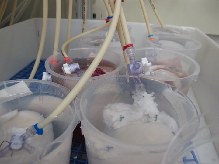 Pig kidneys get cleansed of their porcine cells in a laboratory at Wake Forest University. The university is experimenting with various ways to create replacement organs for human implantation.