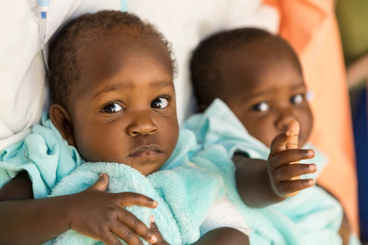 Acen (bottom) and Apio (top) Akello the morning before their separation surgery at Nationwide Children`s Hospital on Sept. 3, 2015.