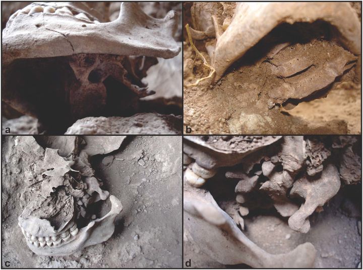 Images of the cervical vertebrae show evidence that the skull was severed in a ritual beheading, researchers say. 