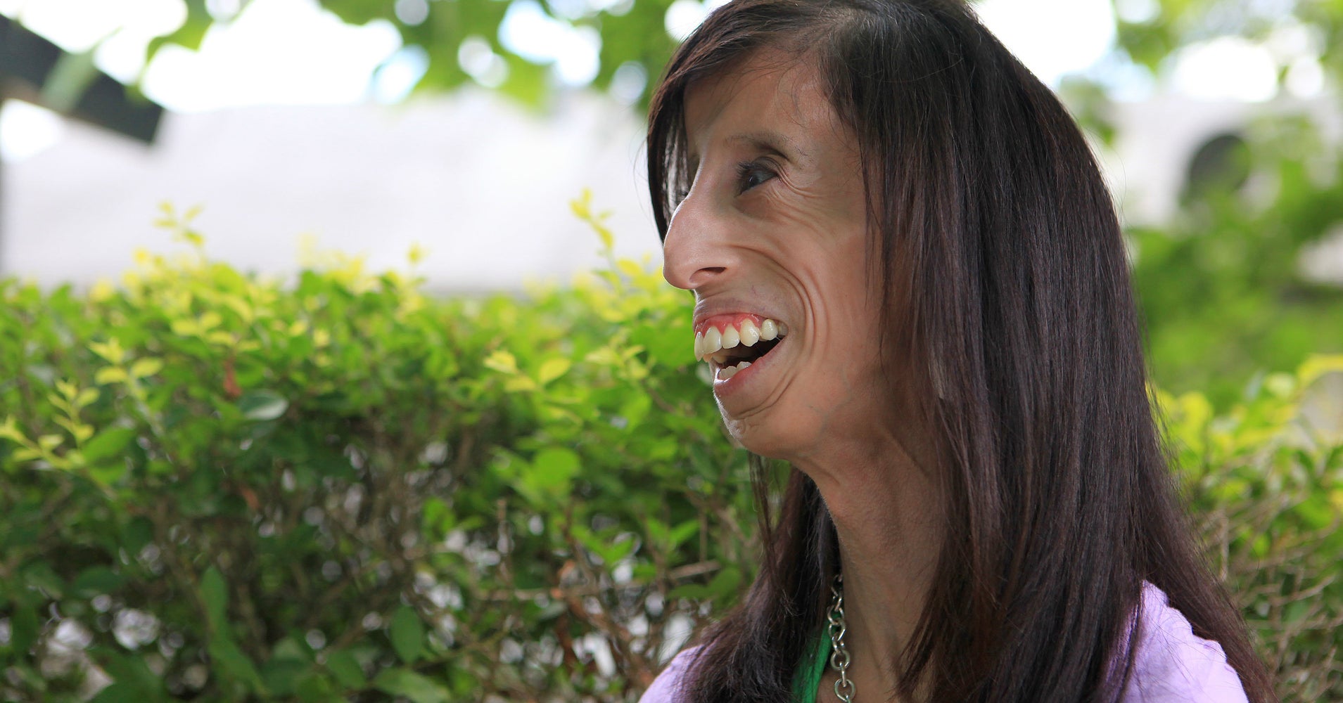 Activist Lizzie Velasquez Knows Beauty Isn't Skin Deep | HuffPost