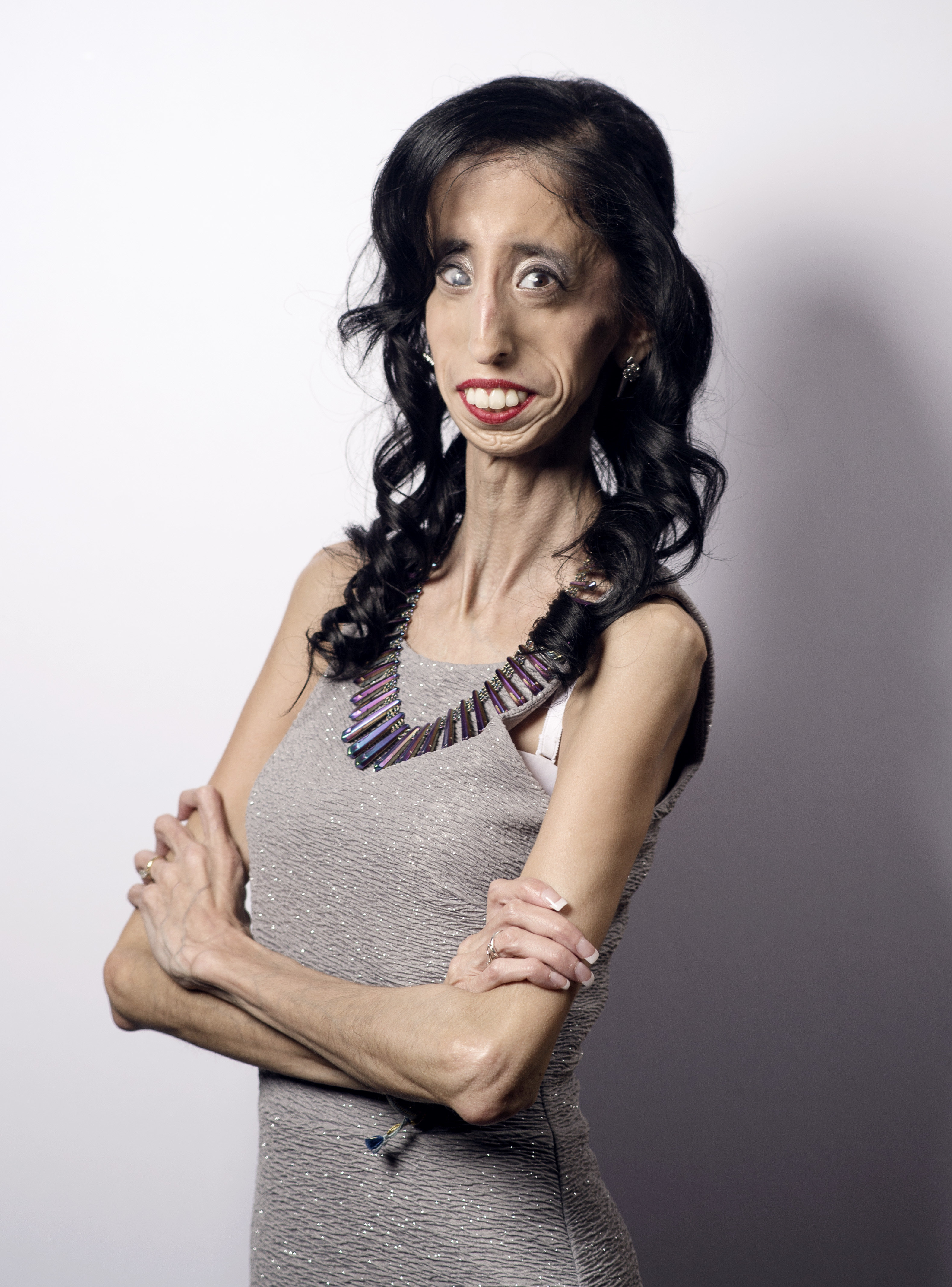 Why Lizzie Velasquez Is Thankful For Her Online Haters HuffPost