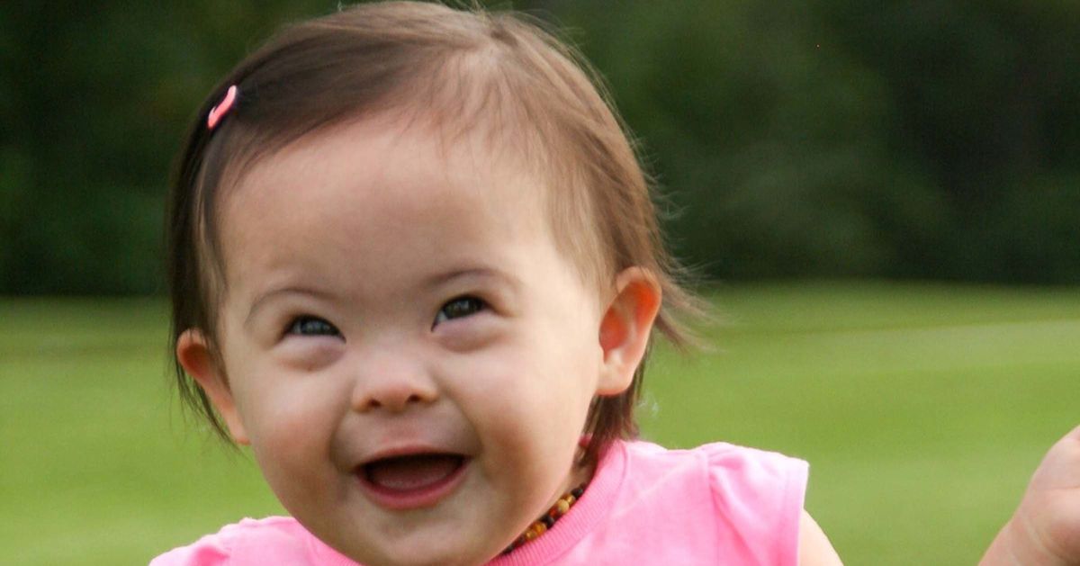 cute down syndrome kids