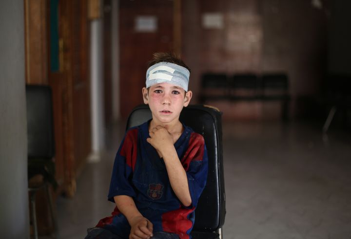 A child receives medical treatment after Syrian regime forces staged an airstrike in Damascus on Sept. 11, 2015.