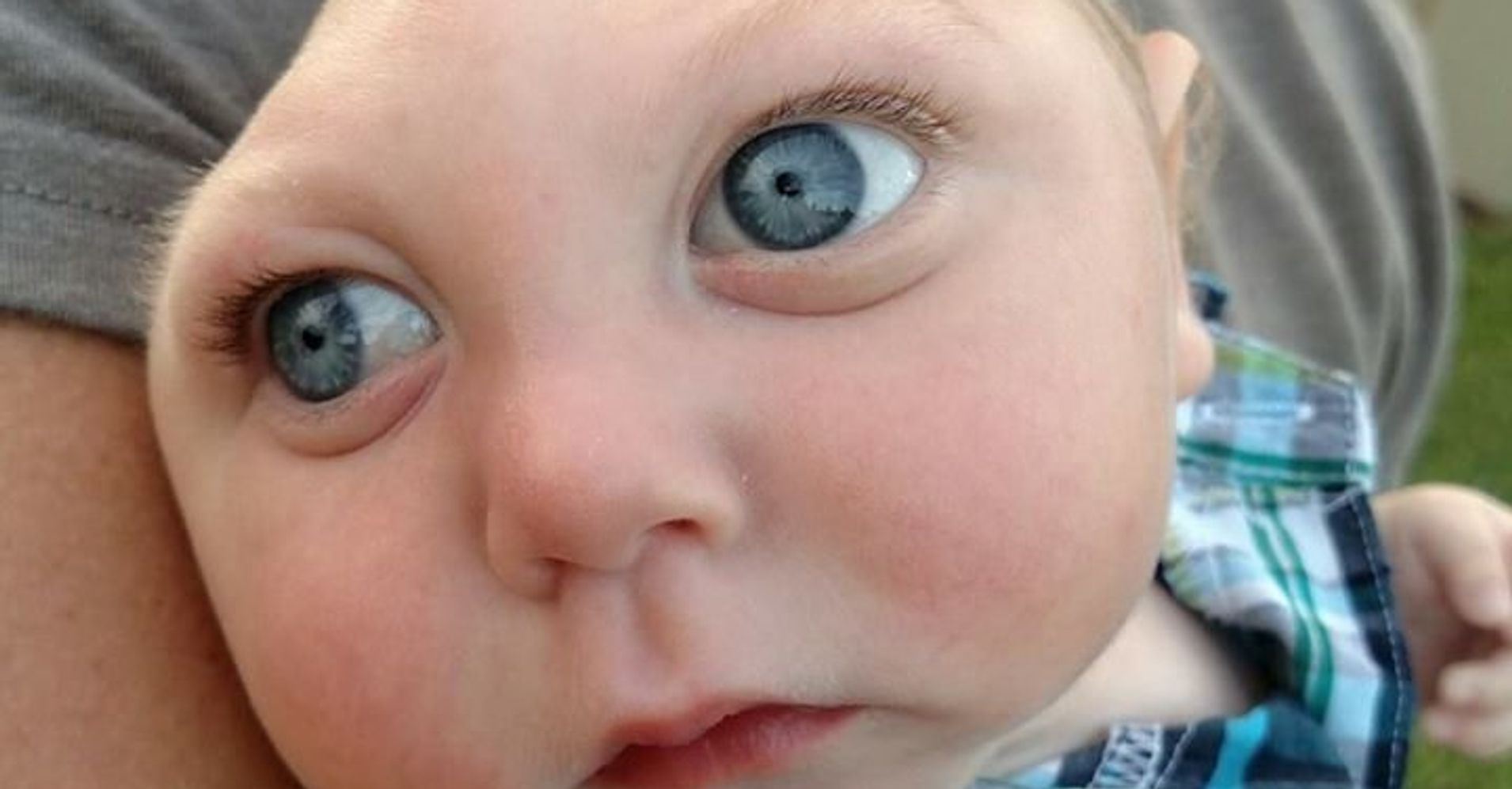 dad-of-baby-born-without-skull-opens-up-after-son-s-story-goes-viral